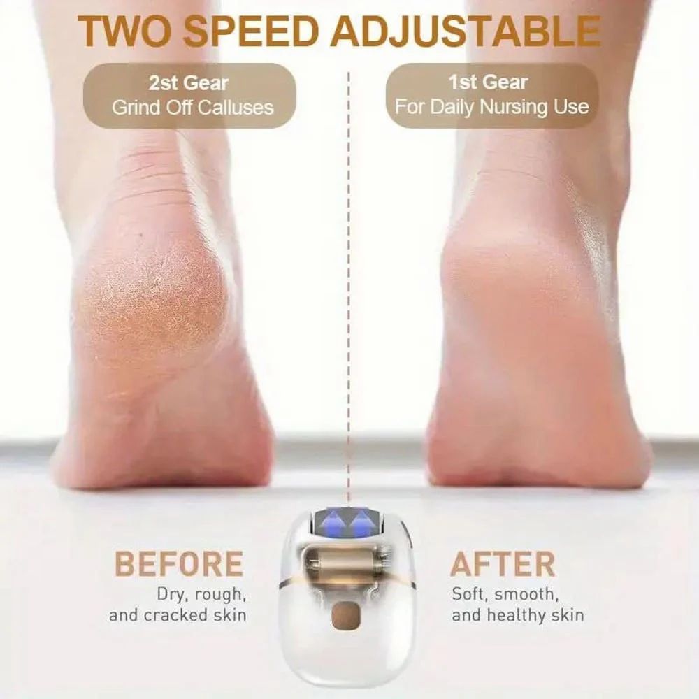 SmoothFeet Pro – Rechargeable Electronic Pedicure Wand